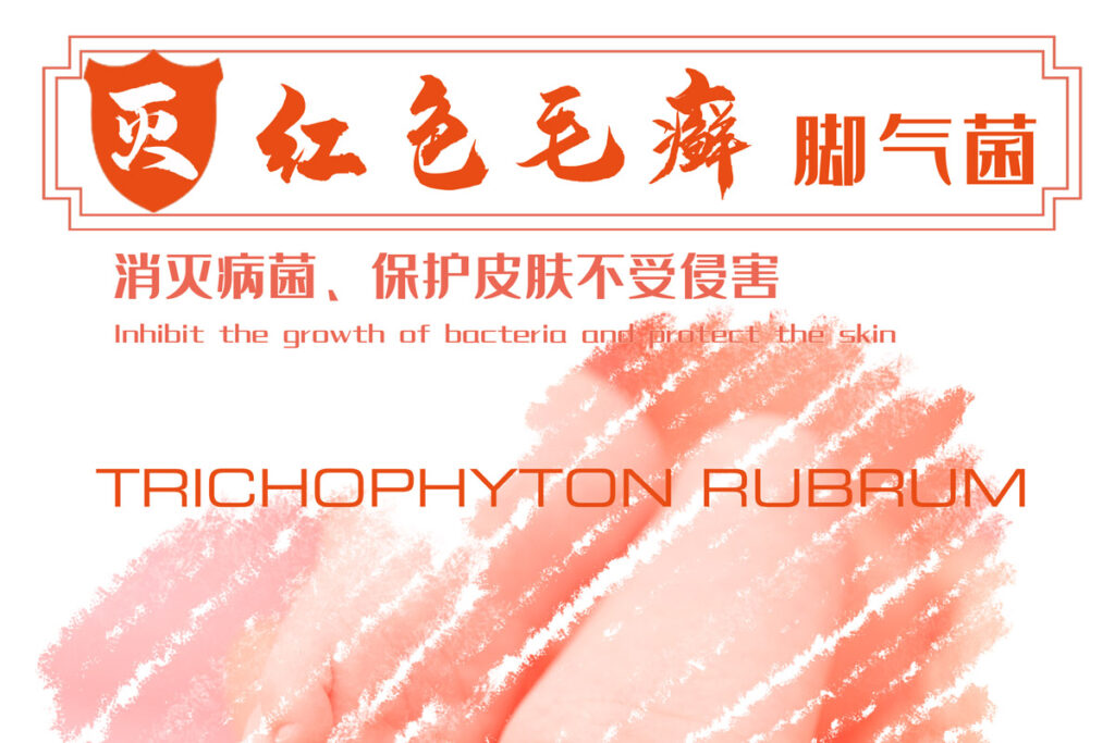 Yarn resistant to Trichophyton Rubrum